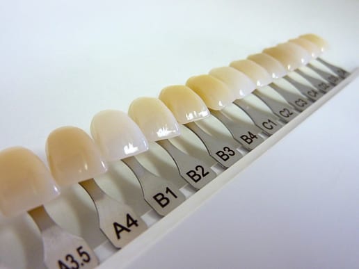Set of dental veneers for tone selection