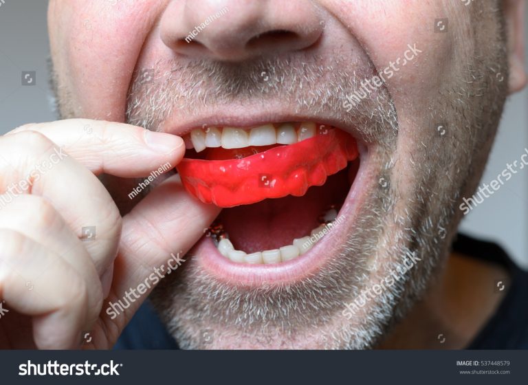 stockphotomanplacingaredbiteplateinhismouthtoprotecthis