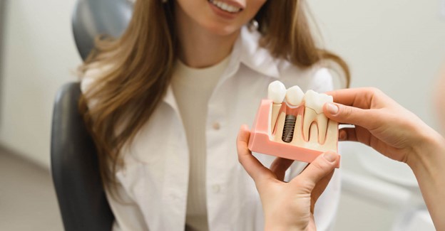 Benefits Of Dental Implants For Missing Teeth