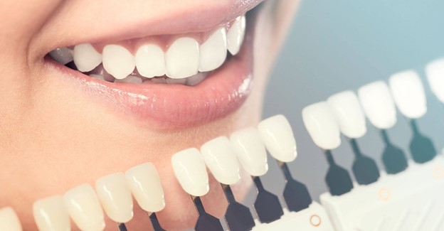 Cosmetic Dentistry to Improve Smile